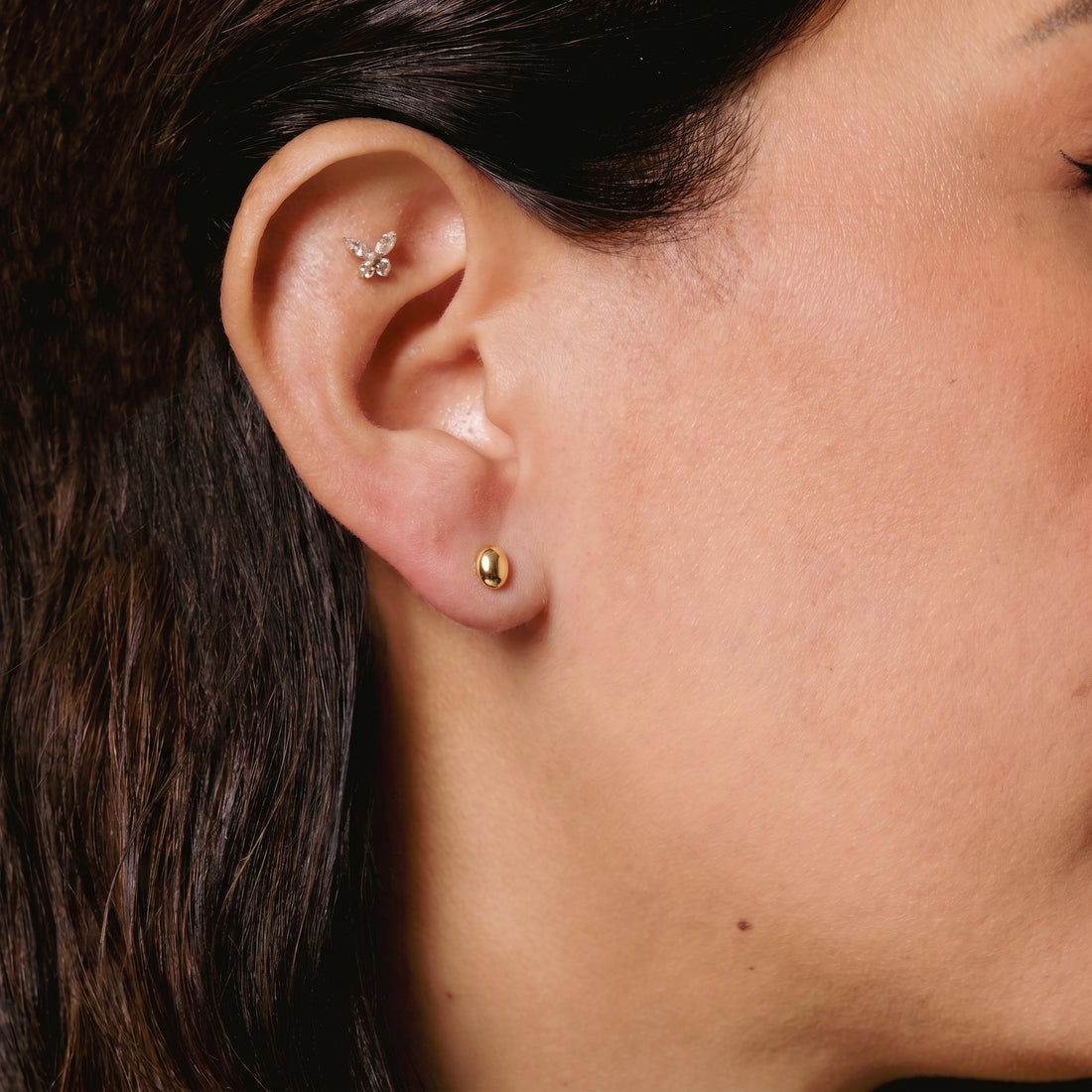 Arete Esferita